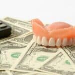 Lohnt sich eine Zusatzversicherung für die Zähne?
